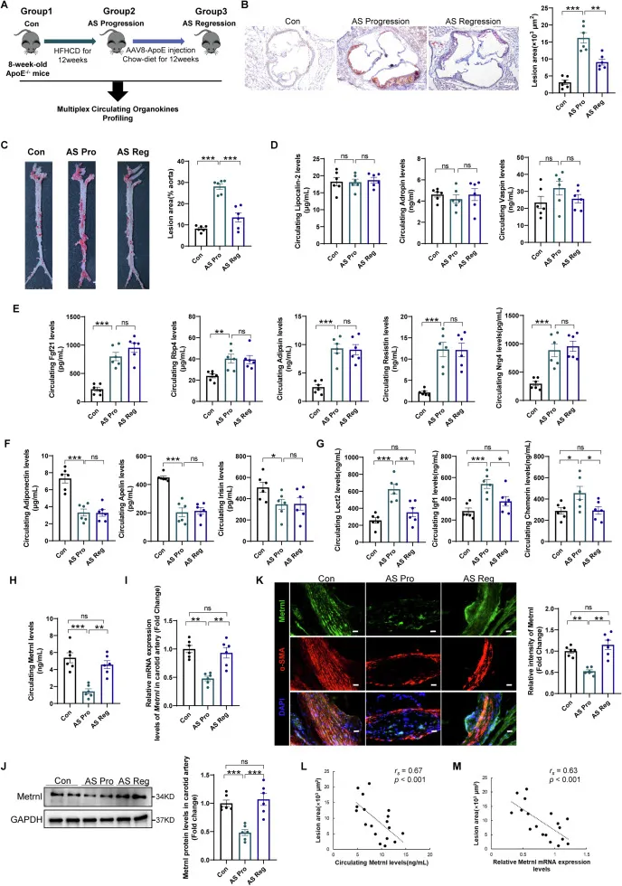 Meteorin-like protein inhibits vascular smooth muscle cell-derived foam cell formation and atherosclerosis via KIT-endoplasmic reticulum stress signaling
